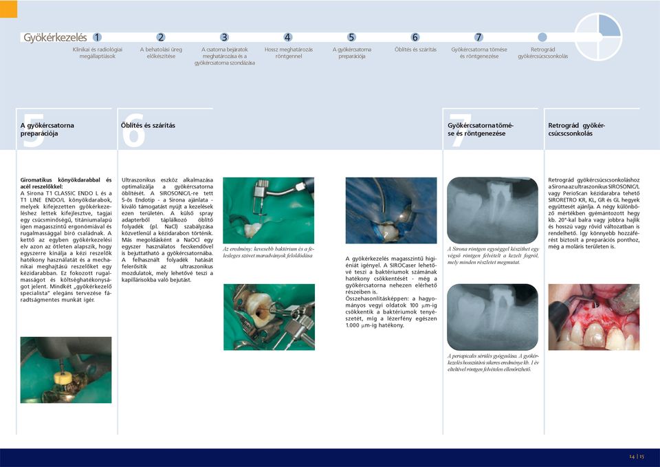 röntgenezése Retrográd gyökércsúcscsonkolás Giromatikus könyökdarabbal és acél reszelőkkel: A Sirona T1 CLASSIC ENDO L és a T1 LINE ENDO/L könyökdarabok, melyek kifejezetten gyökérkezeléshez lettek