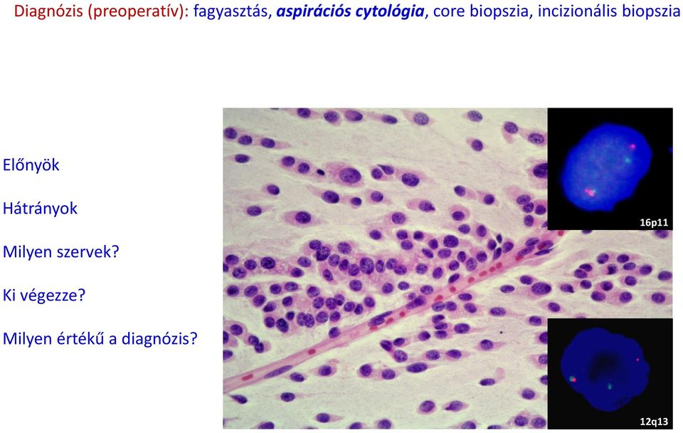 incizionális biopszia Előnyök Hátrányok