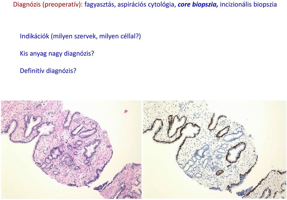 incizionális biopszia Indikációk (milyen