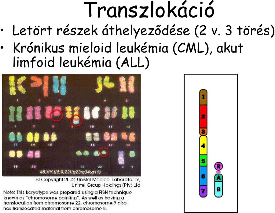 3 törés) Krónikus mieloid