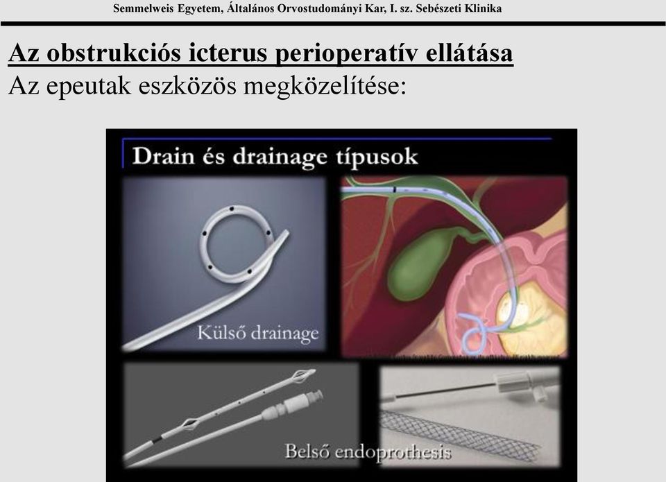 perioperatív