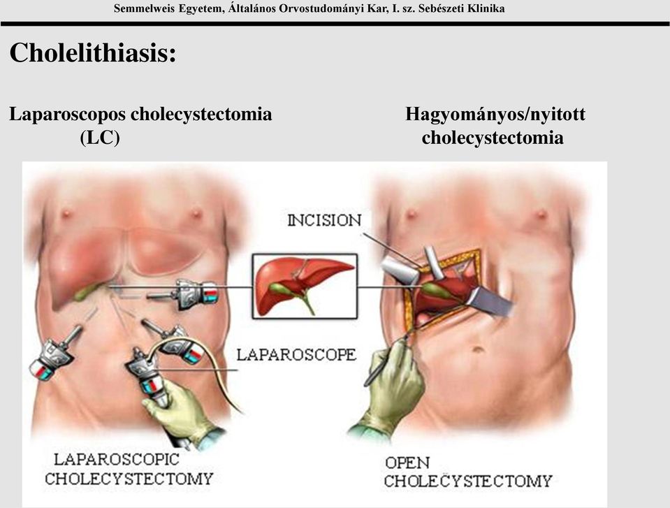 Sebészeti Klinika Laparoscopos