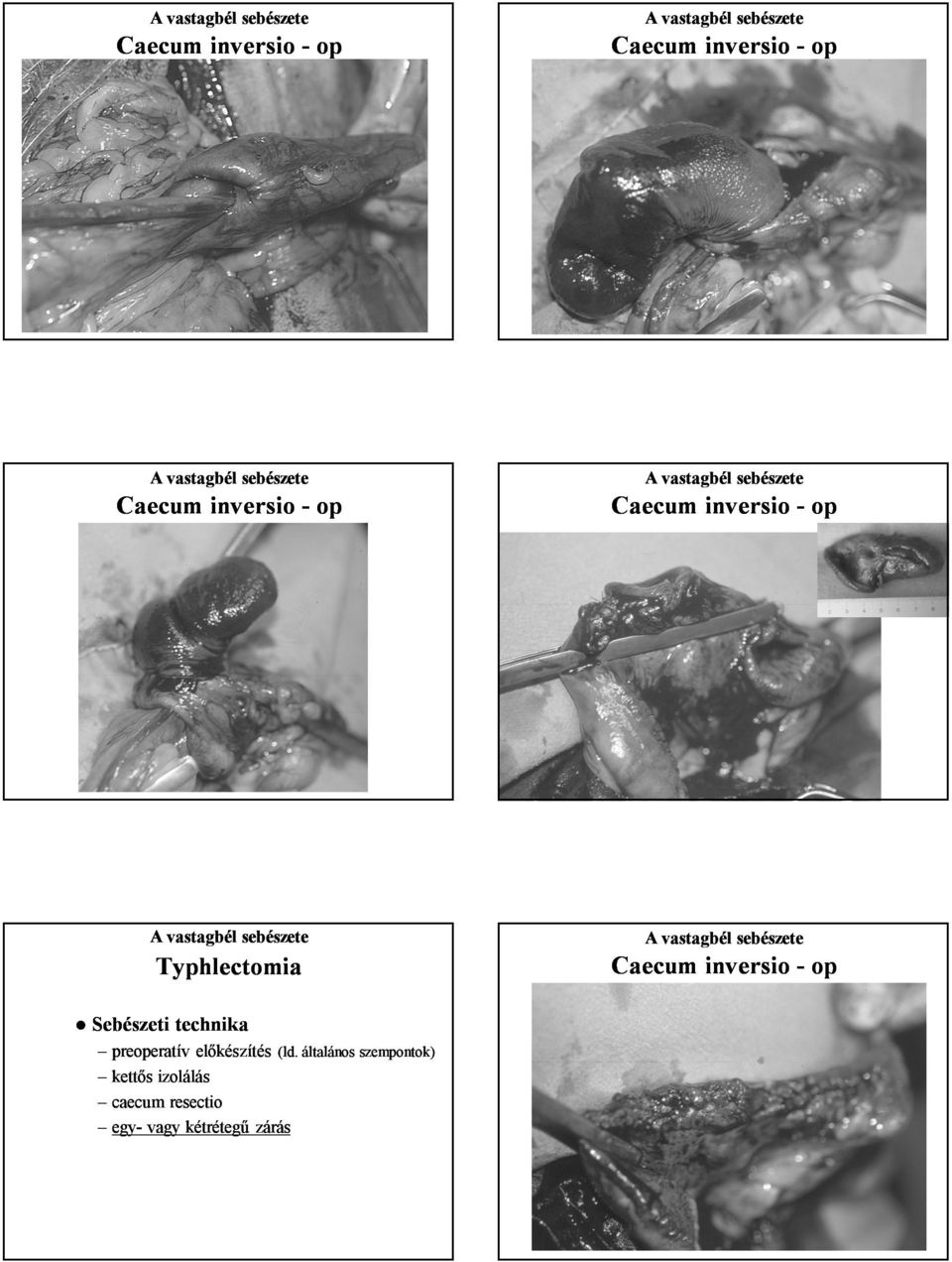 Sebészeti technika preoperatív előkészítés (ld.