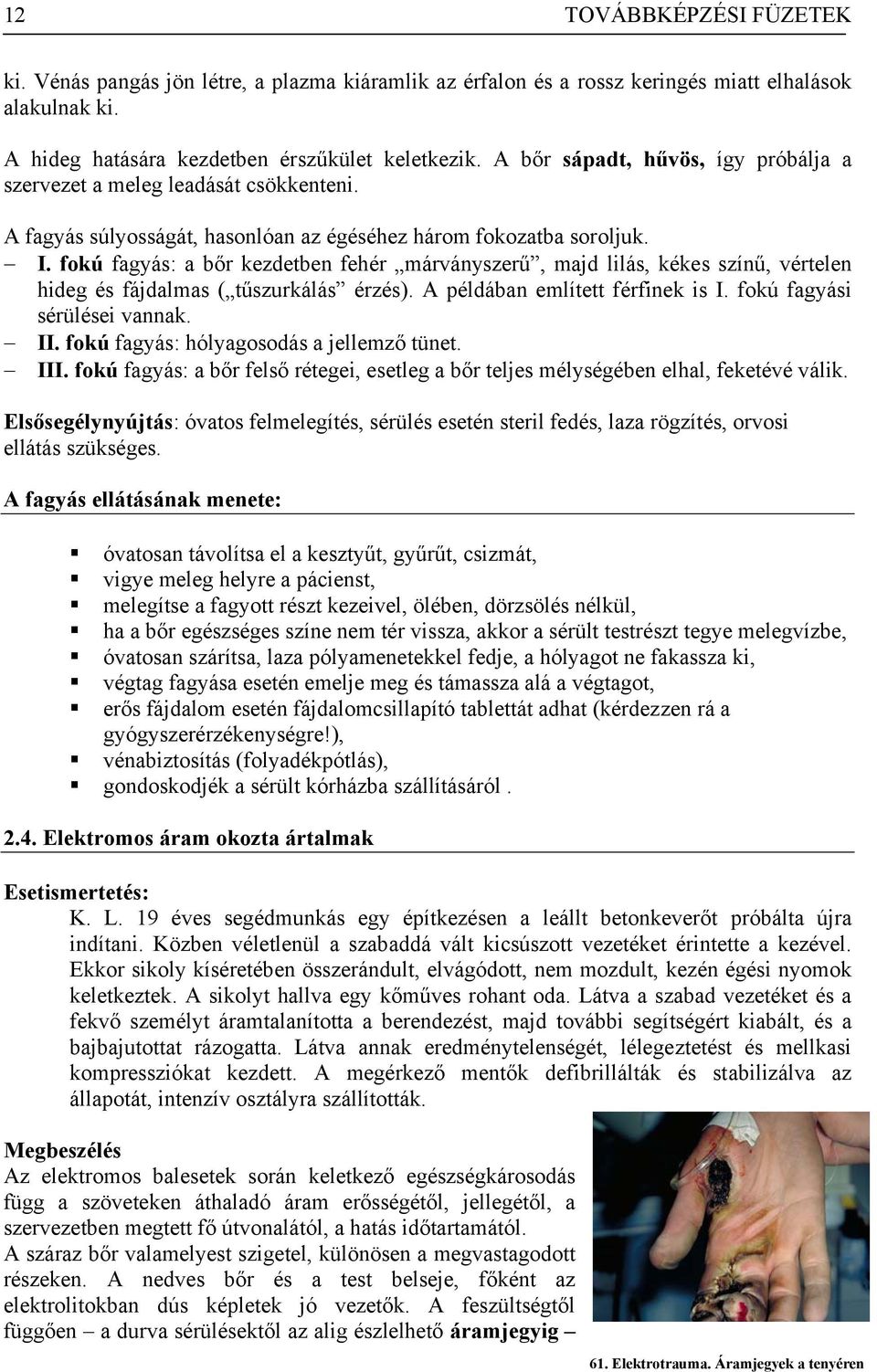 fokú fagyás: a bőr kezdetben fehér márványszerű, majd lilás, kékes színű, vértelen hideg és fájdalmas ( tűszurkálás érzés). A példában említett férfinek is I. fokú fagyási sérülései vannak. II.