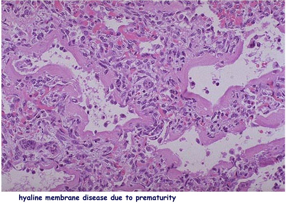 disease