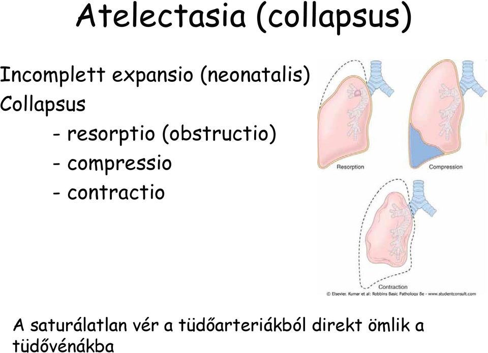 (obstructio) - compressio - contractio A
