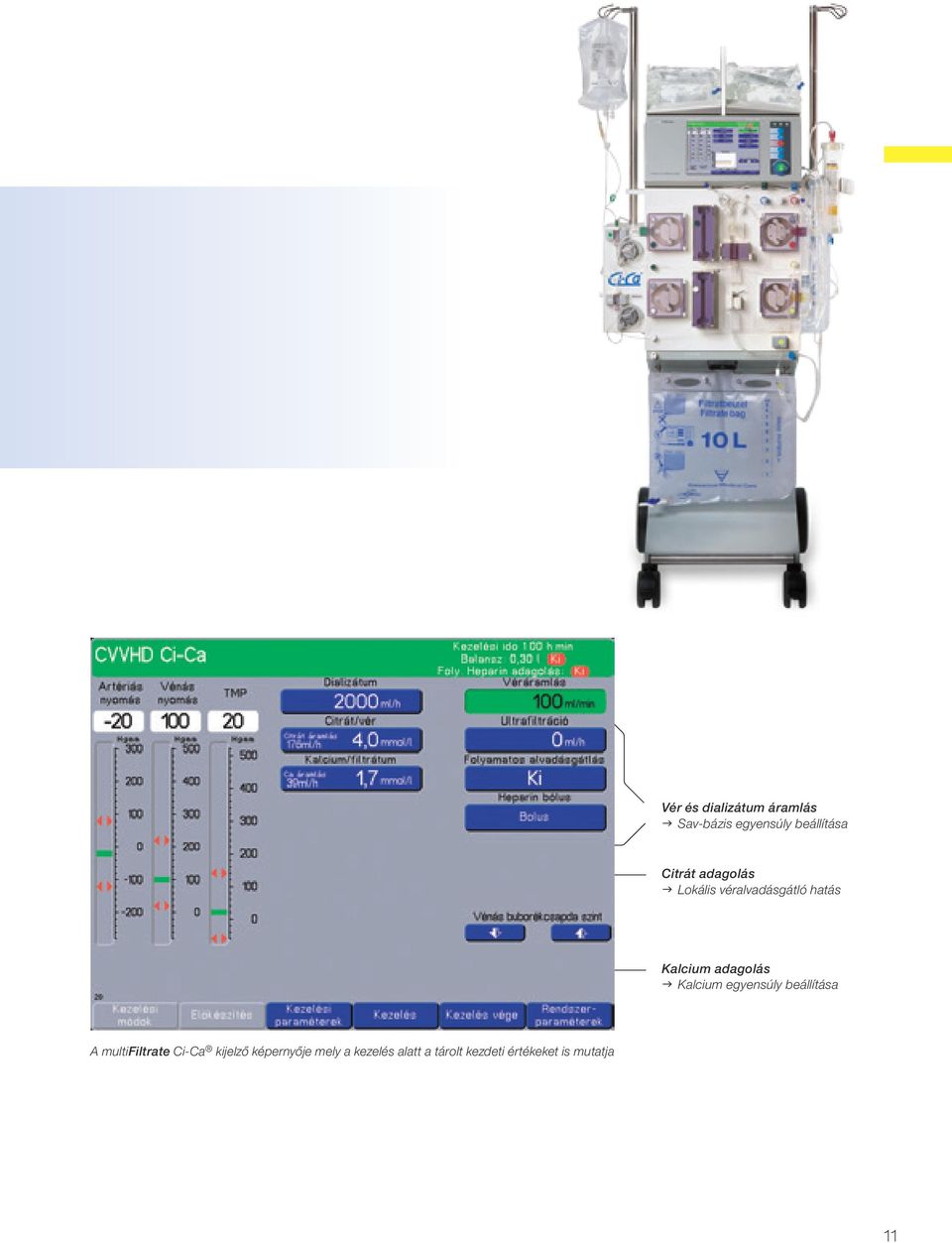 Kalcium egyensúly beállítása A multifiltrate Ci-Ca kijelző