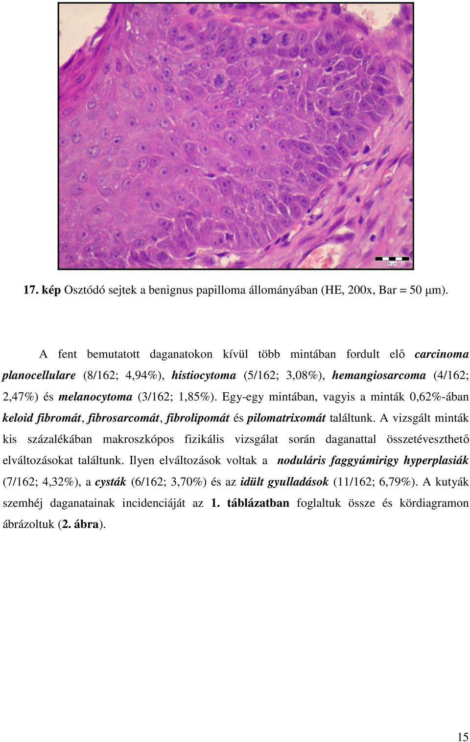 Egy-egy mintában, vagyis a minták 0,62%-ában keloid fibromát, fibrosarcomát, fibrolipomát és pilomatrixomát találtunk.