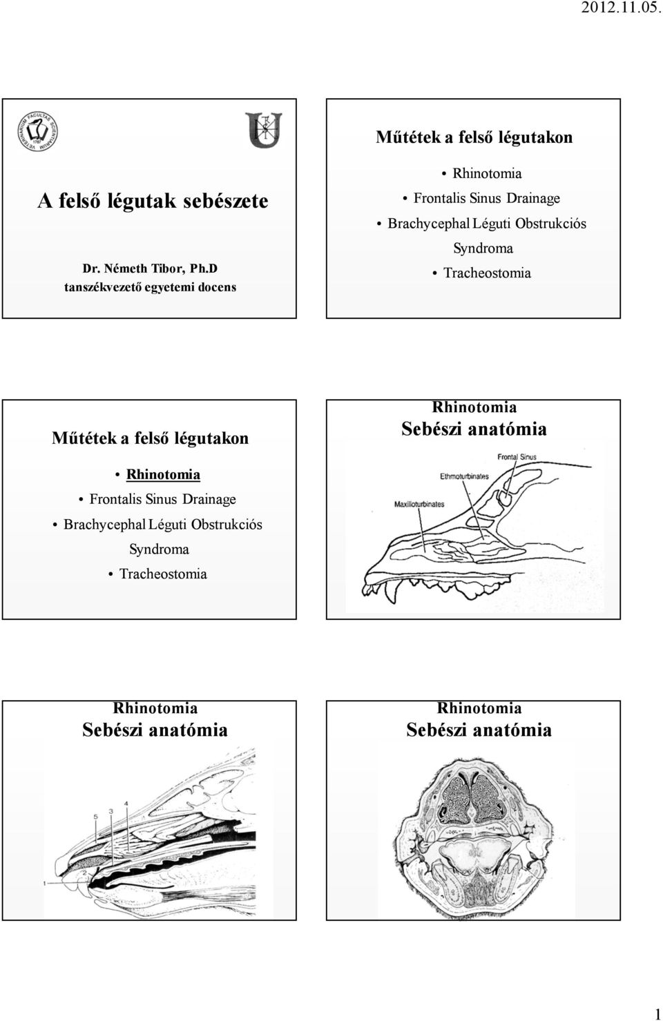 Obstrukciós Syndroma Tracheostomia Műtétek a felső légutakon Sebészi anatómia