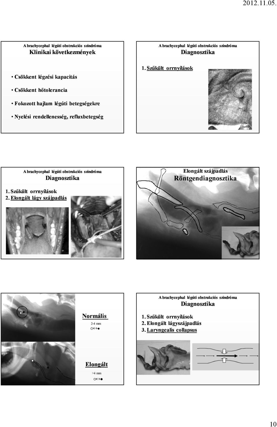 rendellenesség, refluxbetegség Diagnosztika Elongált szájpadlás Röntgendiagnosztika 1.