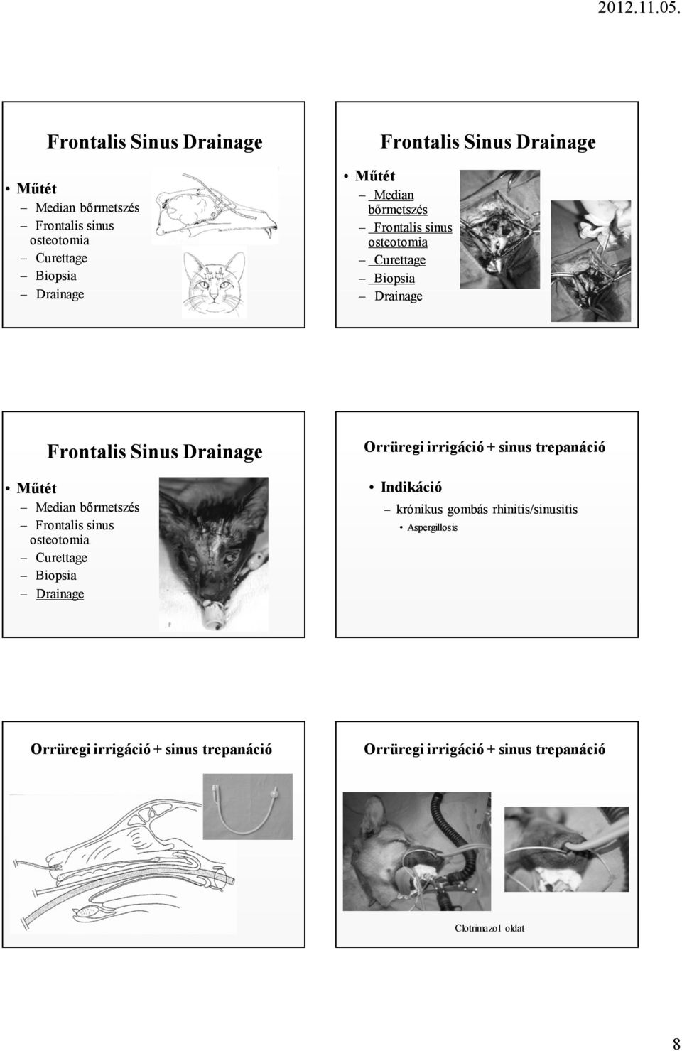 Frontalis sinus osteotomia Curettage Biopsia Orrüregi irrigáció + sinus trepanáció Indikáció krónikus gombás