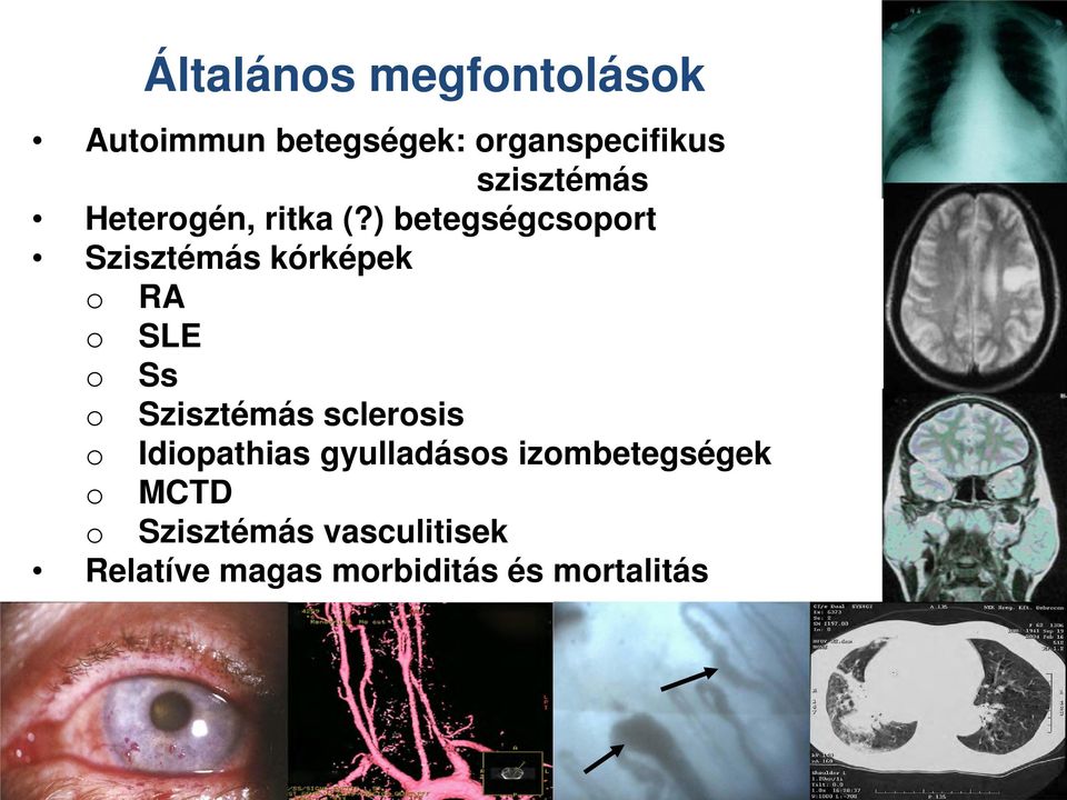 ) betegségcsoport Szisztémás kórképek o RA o SLE o Ss o Szisztémás