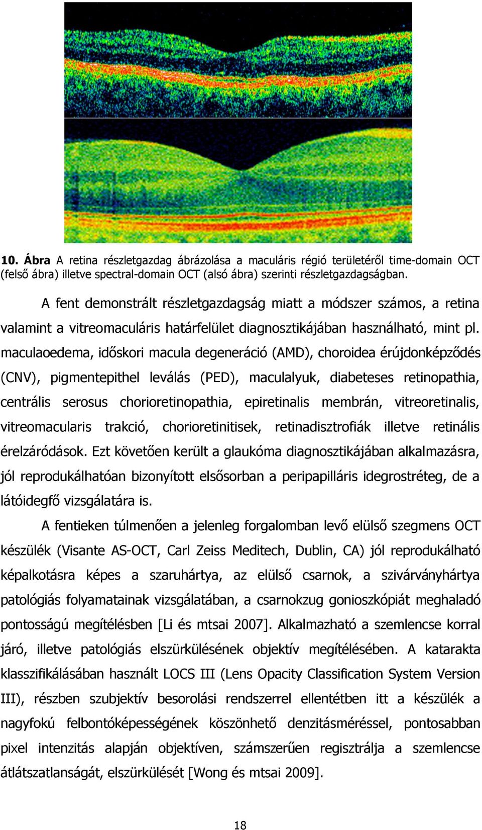 maculaoedema, időskori macula degeneráció (AMD), choroidea érújdonképződés (CNV), pigmentepithel leválás (PED), maculalyuk, diabeteses retinopathia, centrális serosus chorioretinopathia, epiretinalis