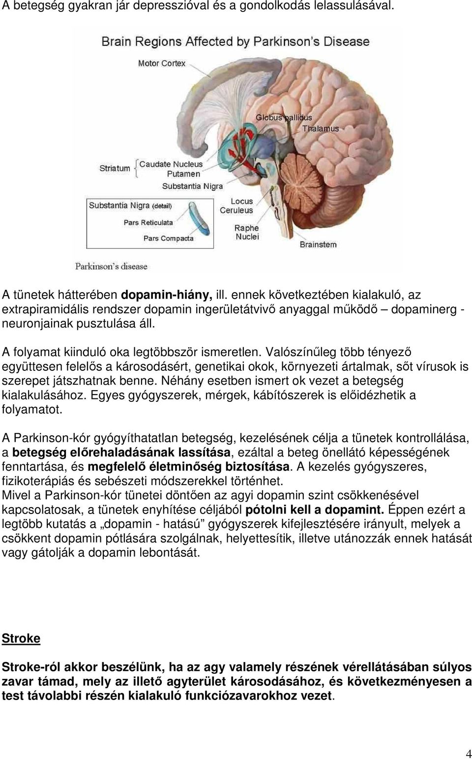 Valószínűleg több tényező együttesen felelős a károsodásért, genetikai okok, környezeti ártalmak, sőt vírusok is szerepet játszhatnak benne. Néhány esetben ismert ok vezet a betegség kialakulásához.