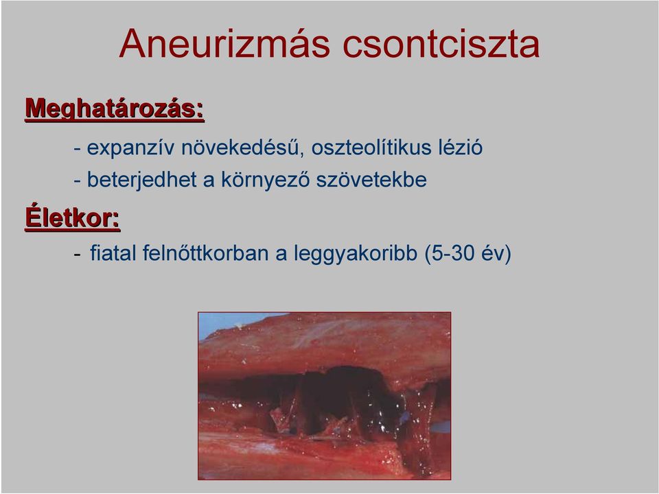 beterjedhet a környező szövetekbe Életkor: