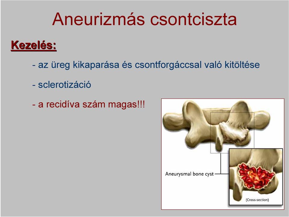 csontforgáccsal való kitöltése -