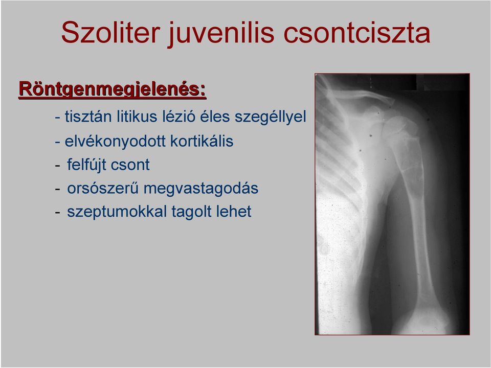 éles szegéllyel - elvékonyodott kortikális -