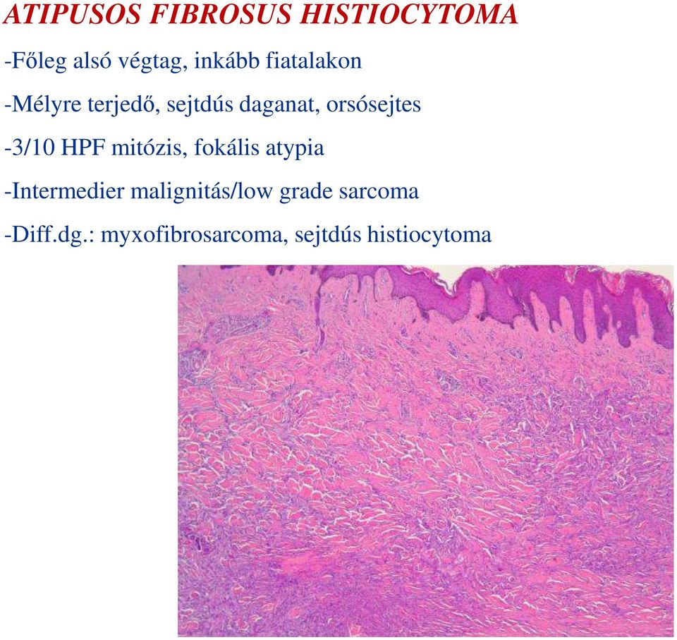 -3/10 HPF mitózis, fokális atypia -Intermedier