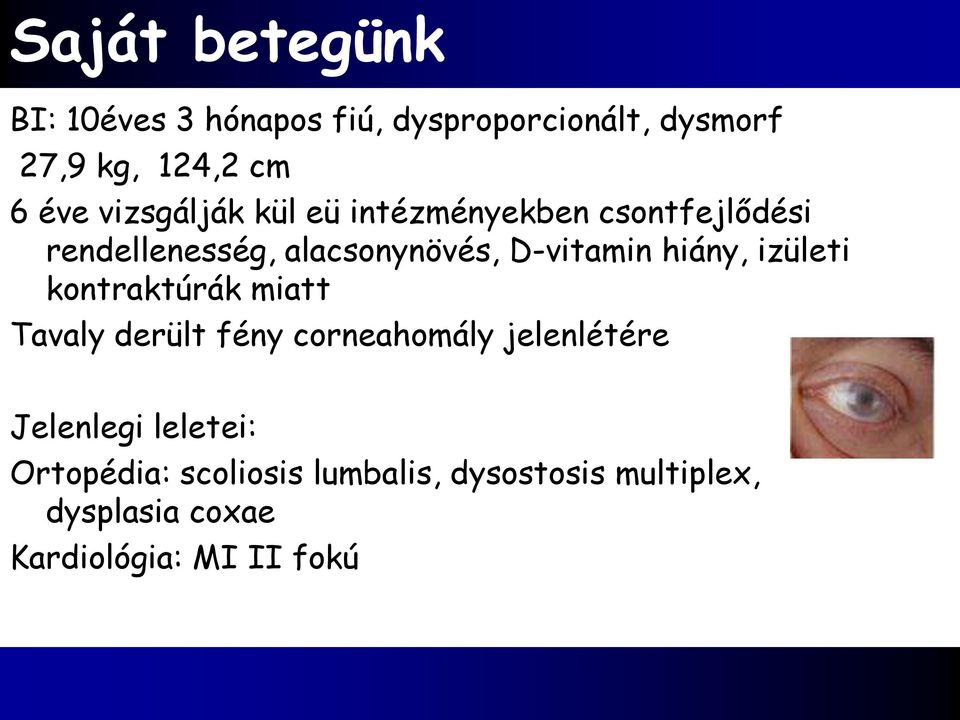hiány, izületi kontraktúrák miatt Tavaly derült fény corneahomály jelenlétére Jelenlegi