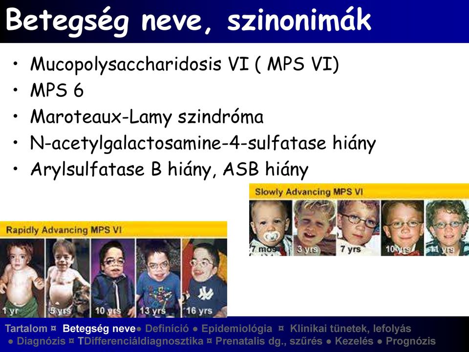 Maroteaux-Lamy szindróma