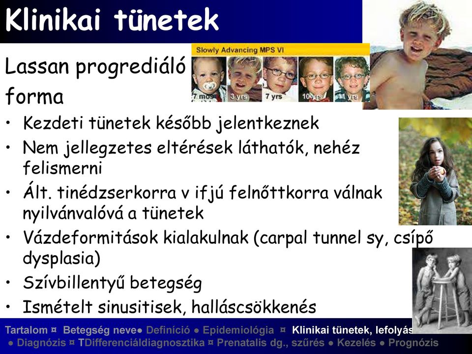 tinédzserkorra v ifjú felnőttkorra válnak nyilvánvalóvá a tünetek Vázdeformitások
