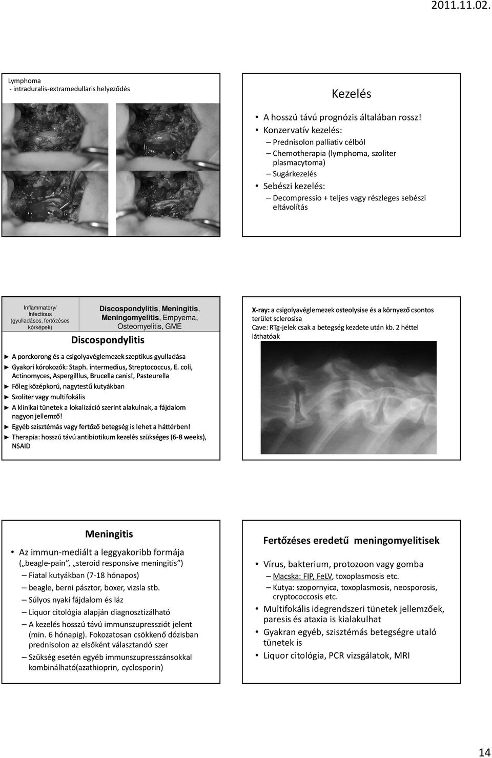 Infectious (gyulladásos, fertızéses kórképek) Discospondylitis, Meningitis, Meningomyelitis, Empyema, Osteomyelitis, GME Discospondylitis X-ray ray:: a csigolyavéglemezek osteolysise és a környező