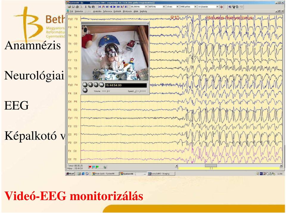 vizsgálat EEG Képalkotó