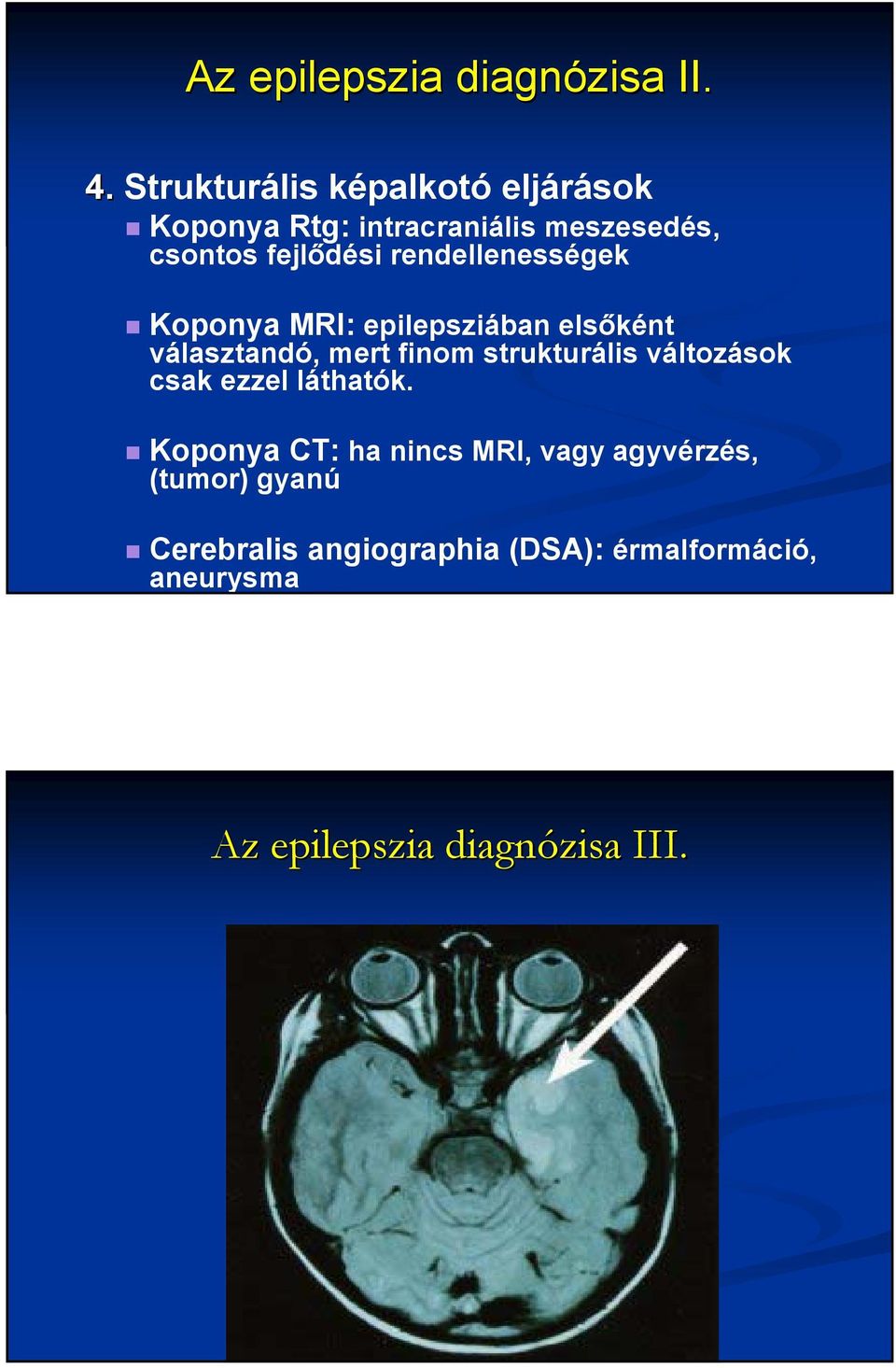 rendellenességek Koponya MRI: epilepsziában elsőként választandó, mert finom strukturális