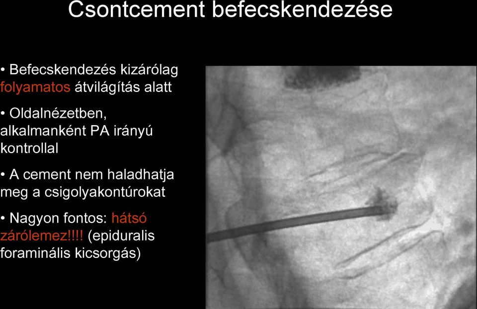 irányú kontrollal A cement nem haladhatja meg a