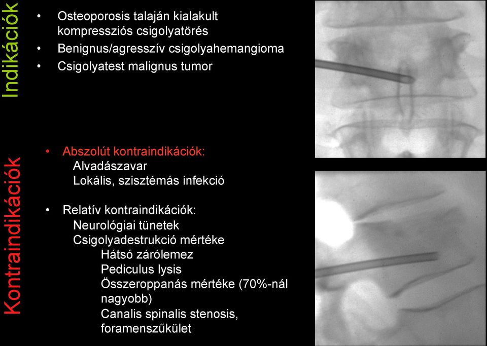 Alvadászavar Lokális, szisztémás infekció Relatív kontraindikációk: Neurológiai tünetek