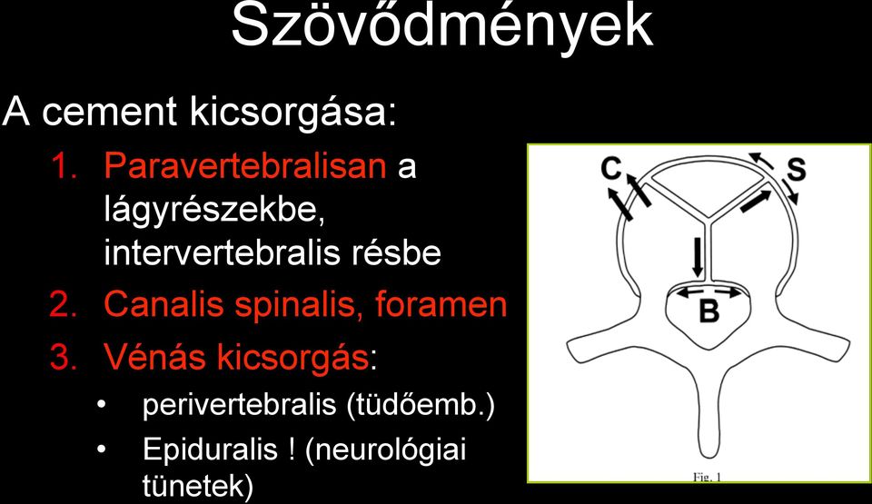 résbe 2. Canalis spinalis, foramen 3.