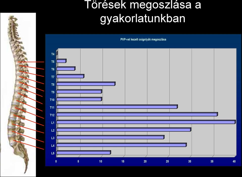 csigolyák megoszlása T4 T5 T6 T7 T8