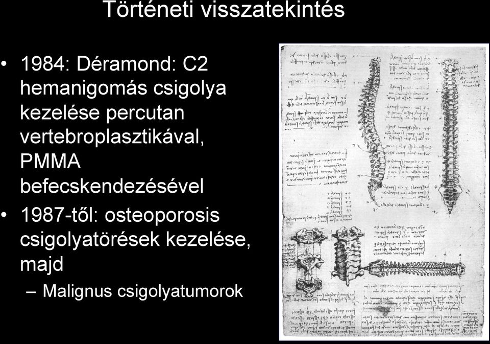 vertebroplasztikával, PMMA befecskendezésével