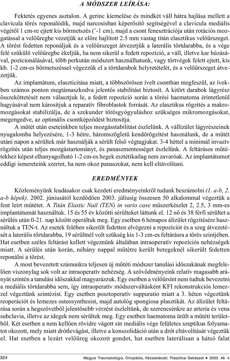 majd a csont fenesztrációja után rotációs mozgatással a velõüregbe vezetjük az elõre hajlított 2.5 mm vastag titán elasztikus velõûrszeget.