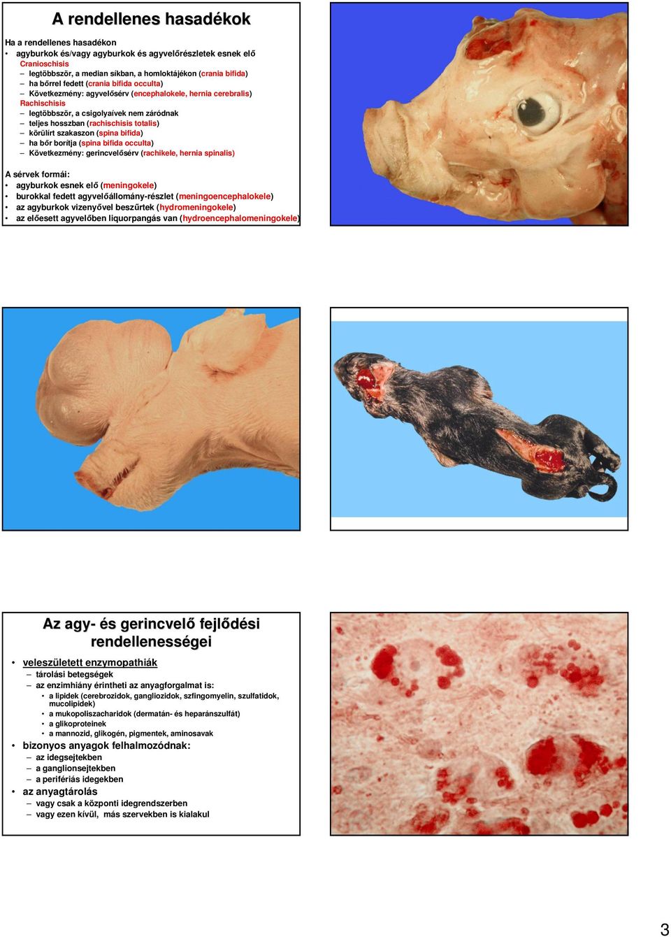 szakaszon (spina bifida) ha bır borítja (spina bifida occulta) Következmény: gerincvelısérv (rachikele, hernia spinalis) A sérvek formái: agyburkok esnek elı (meningokele) burokkal fedett