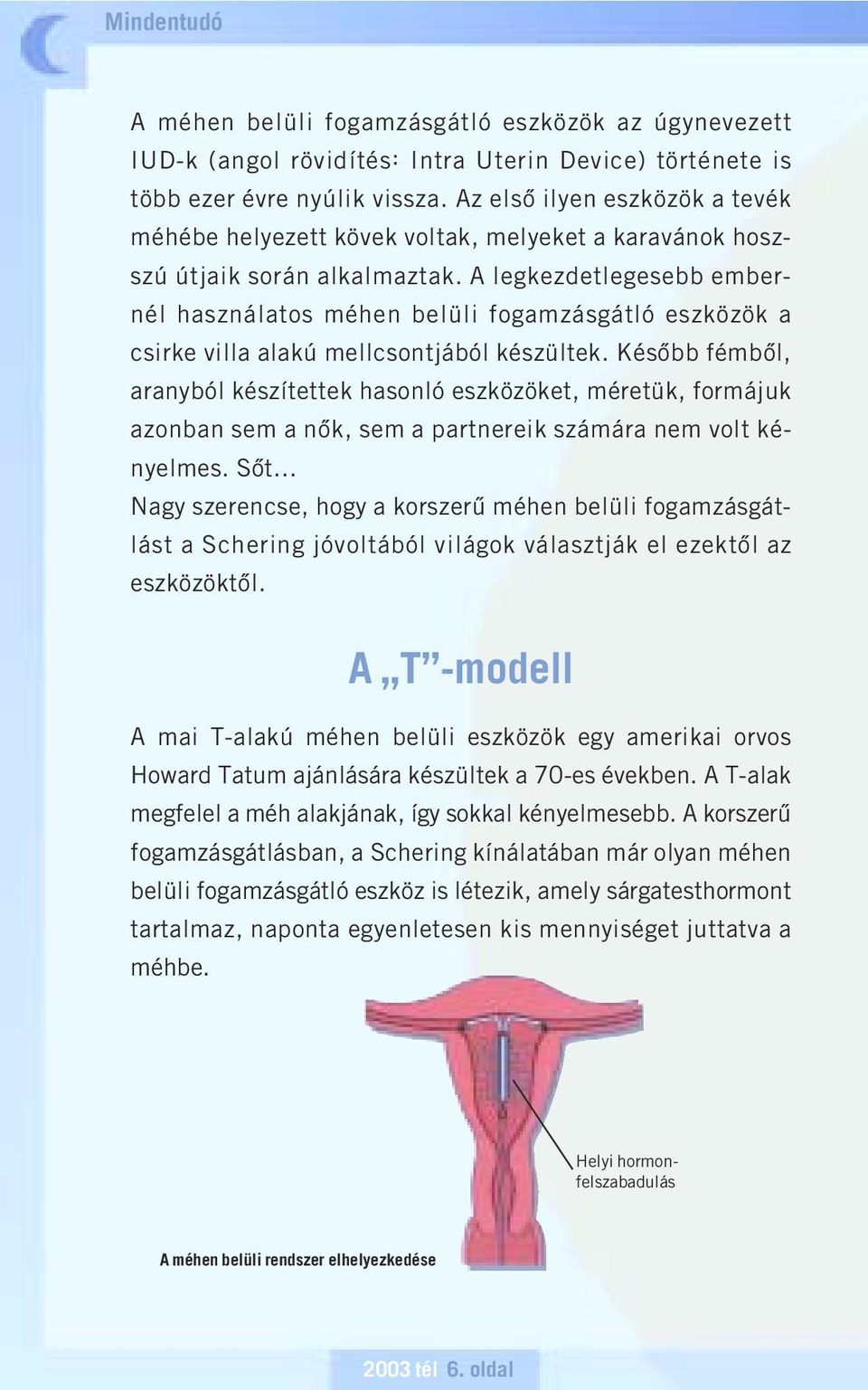 A legkezdetlegesebb embernél használatos méhen belüli fogamzásgátló eszközök a csirke villa alakú mellcsontjából készültek.