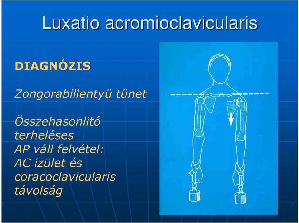 a vállízület myositis kezelése)