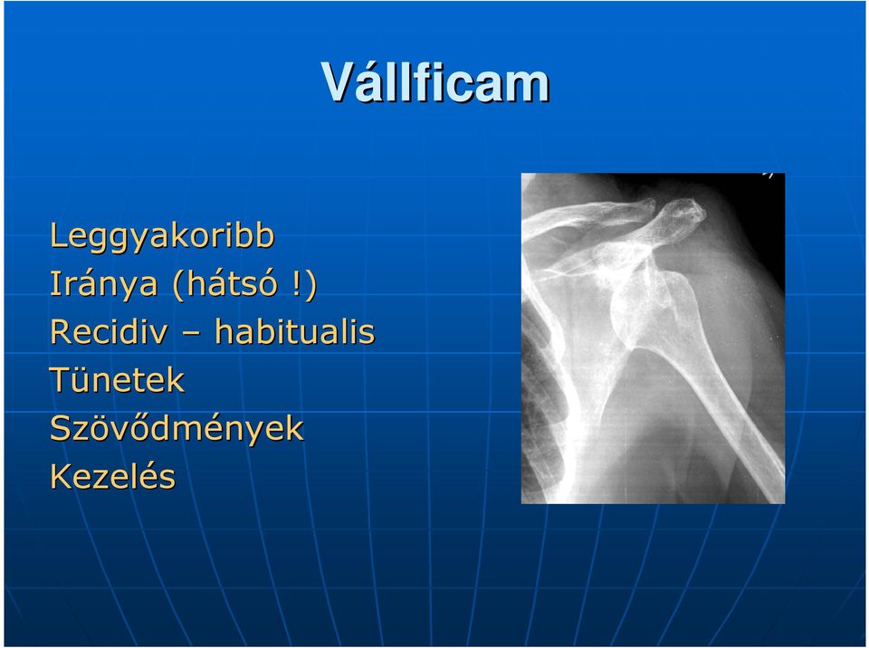 könyökízületi kezelés myositis fórum ízületi gyulladás és ízületi gyulladás kezelésére
