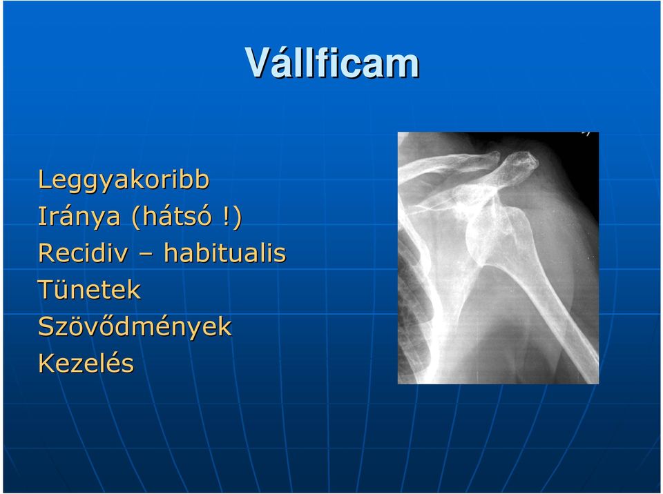 ) Recidiv habitualis