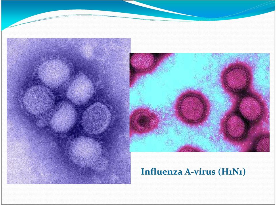 (H1N1)
