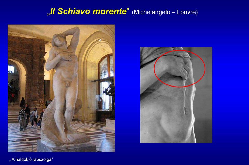 Schiavo morente