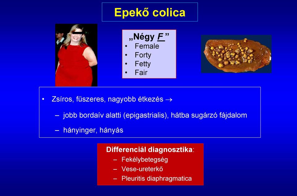 (epigastrialis), hátba sugárzó fájdalom hányinger, hányás