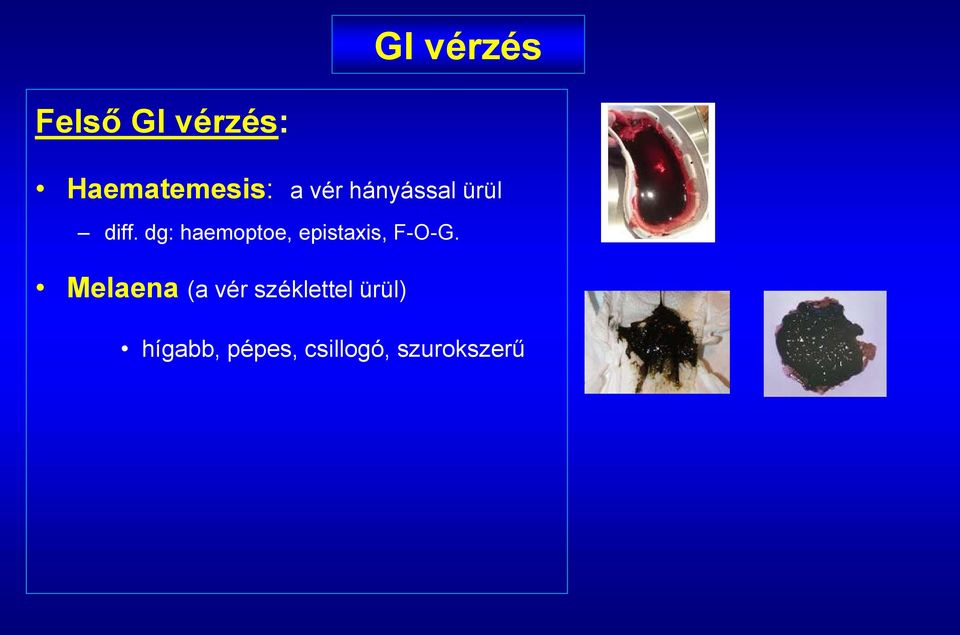 dg: haemoptoe, epistaxis, F-O-G.