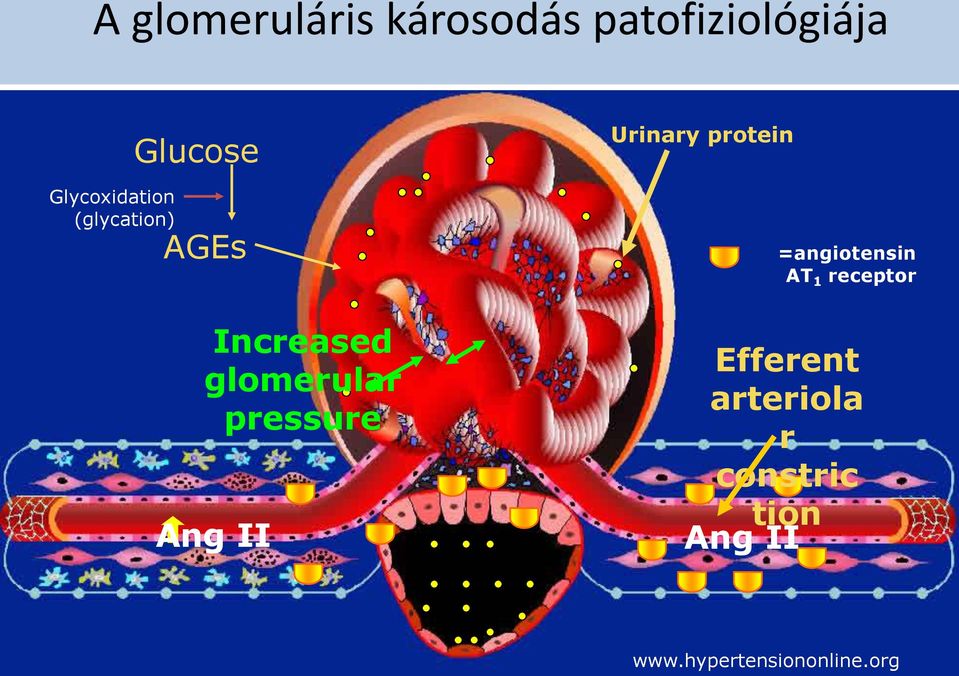 Urinary protein =angiotensin AT 1 receptor Efferent arteriola r