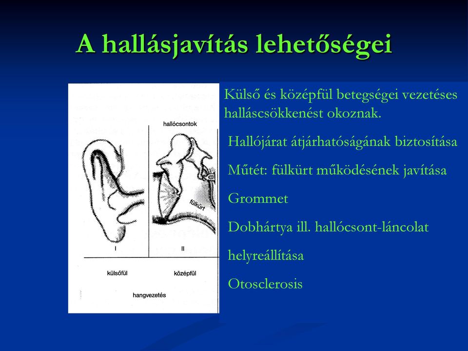 Hallójárat átjárhatóságának biztosítása Műtét: fülkürt