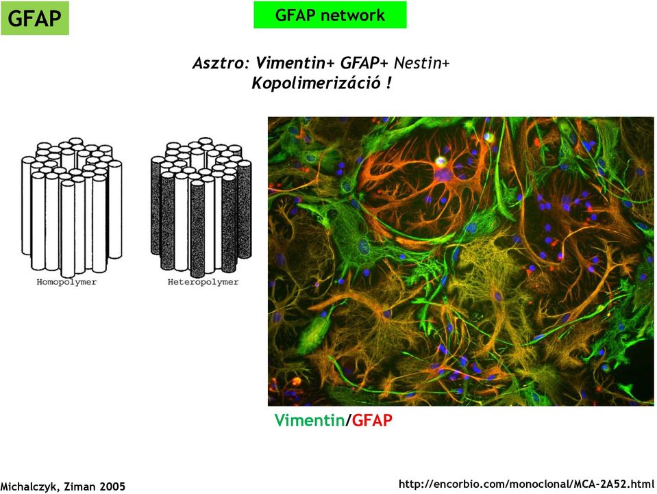 Vimentin/GFAP Michalczyk, Ziman
