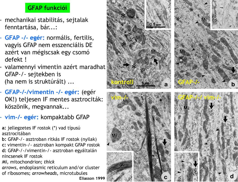 .. - vim-/- egér: kompaktabb GFAP a: jellegzetes IF rostok (*) vad típusú asztrocitában b: GFAP-/- asztroban ritkás IF rostok (nyilak) c: vimentin-/- asztroban kompakt GFAP rostok d: