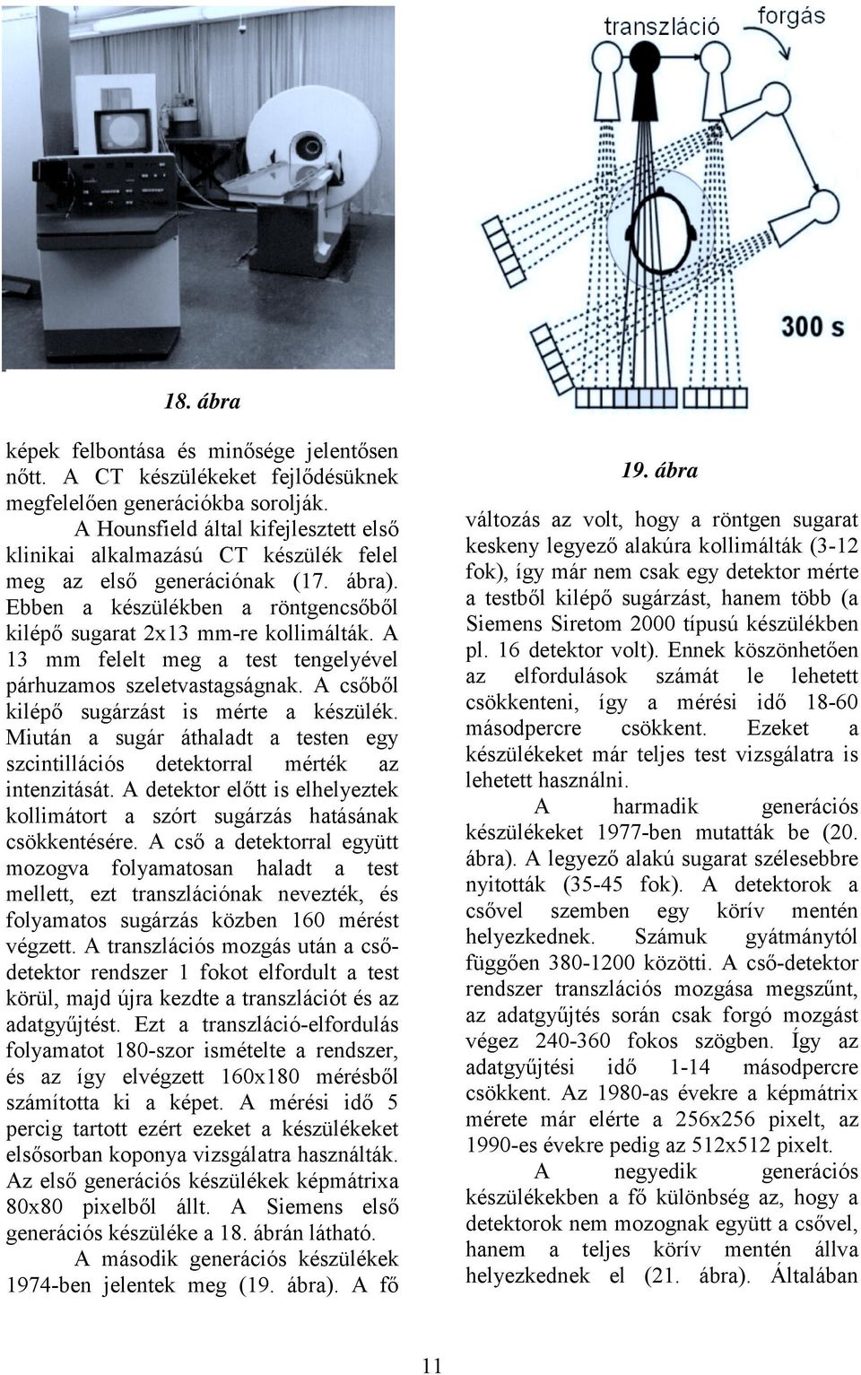 A 13 mm felelt meg a test tengelyével párhuzamos szeletvastagságnak. A csőből kilépő sugárzást is mérte a készülék.