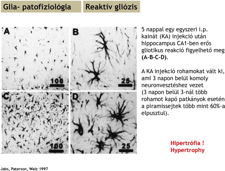kainát (KA) injekció után hippocampus CA1-ben erős gliotikus reakció figyelhető meg