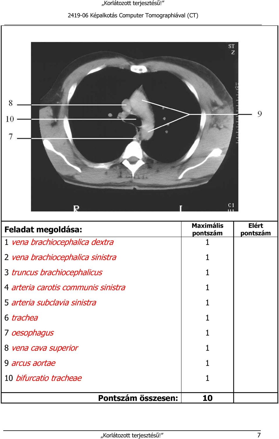 communis sinistra 5 arteria subclavia sinistra 6 trachea 7 oesophagus 8 vena cava